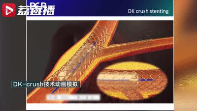 DƬ